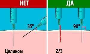 Как правильно делать укол в ягодицу самостоятельно