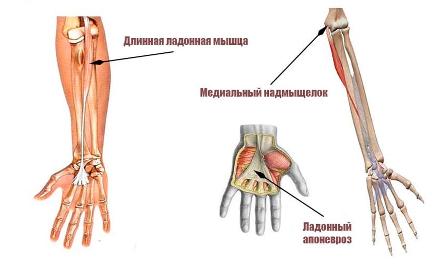 Длинная ладонная мышца