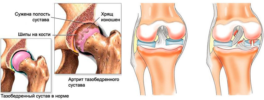 Соединительная ткань