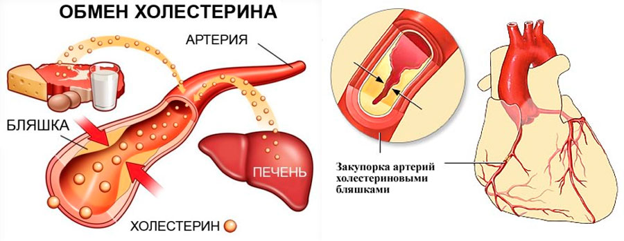 обмен холестерина